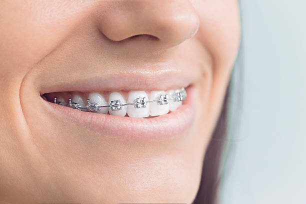 Best Traditional Braces  in Lucerne, CA